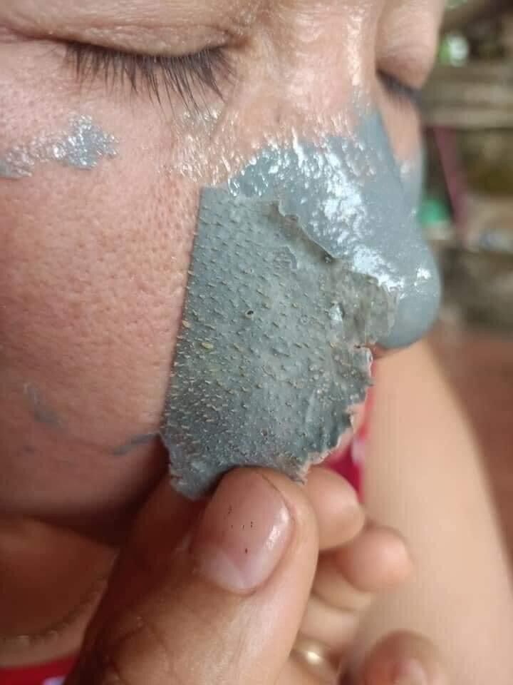 combo 2gel lột mụn dr. acne