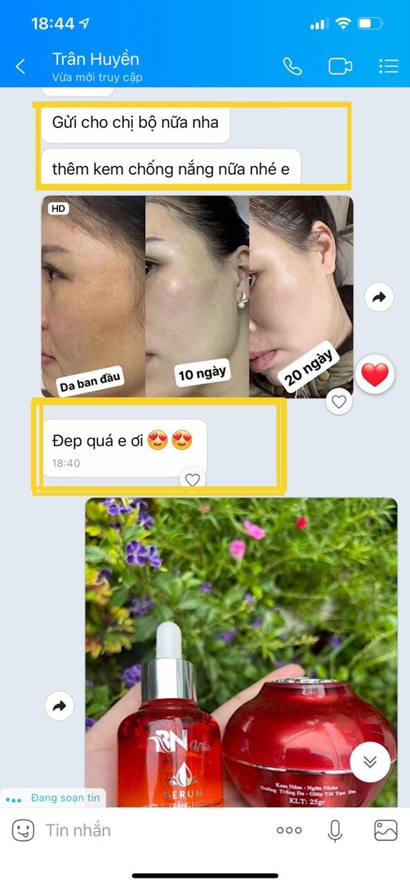[HCM]DƯỠNG DA TRẮNG SÁNG - MỜ NÁM BN WHITE
