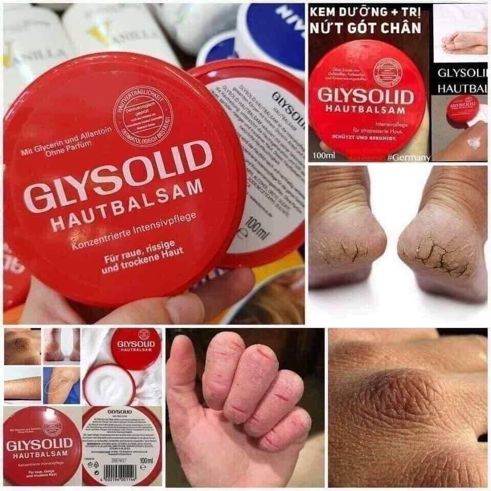 Kem nẻ GLYSOLID hũ 100ml