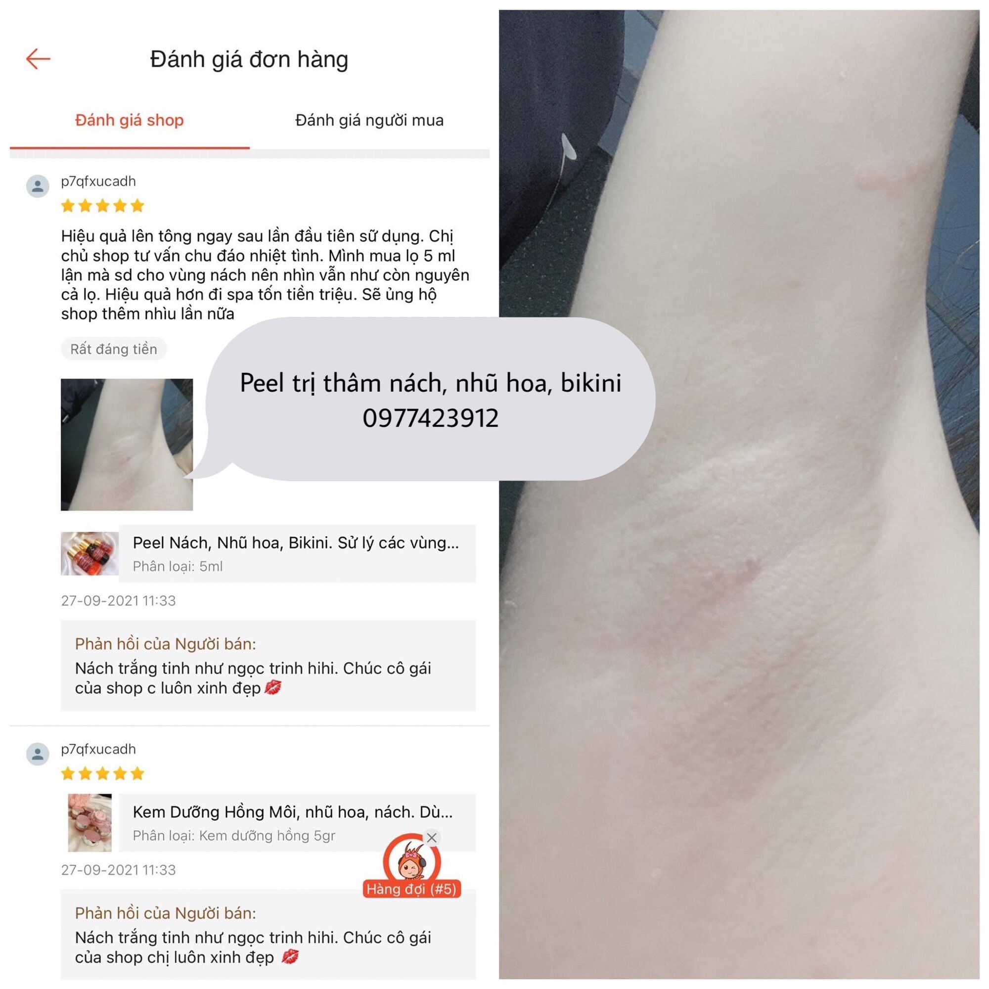 Peel Làm Hồng Nách, Nhũ Hoa, BiKiNi