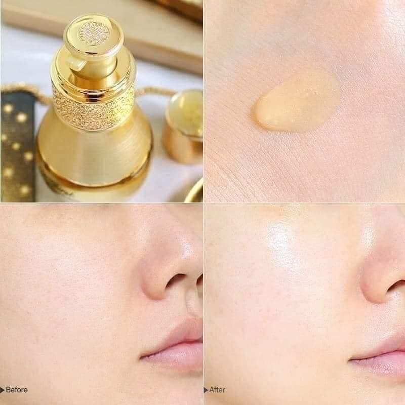 Tinh chất siêu vi tái sinh da Ohui The First Geniture Sym – Micro Essence