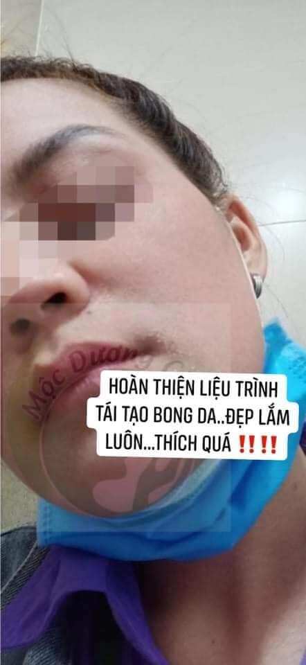 Combo bột rửa mặt + tái tạo Mộc Dương Châu