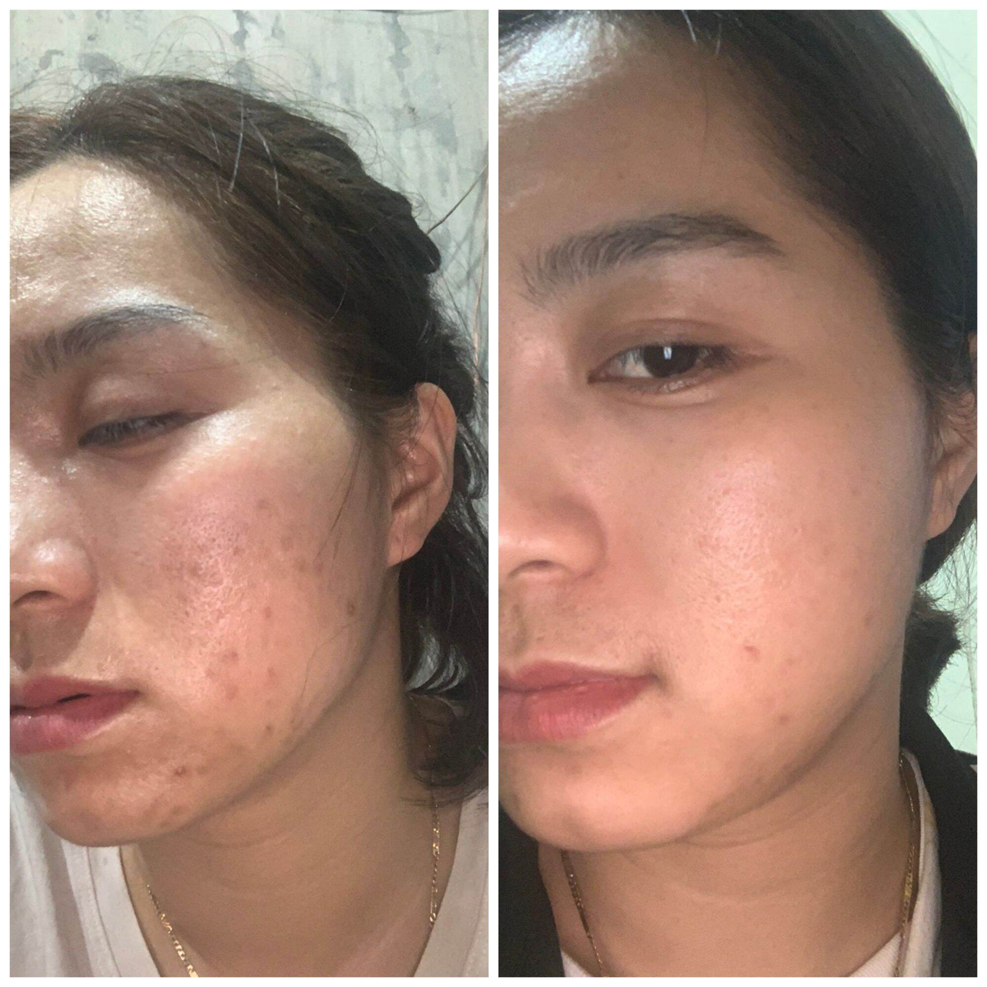 Đông y Sắc Ngọc Nữ tái tạo da