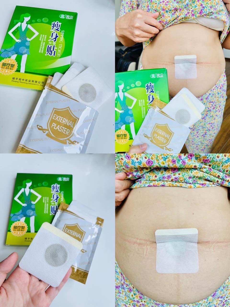 Miếng Dán Tan Mỡ Nội Địa Trung ( hộp 10 Miếng )