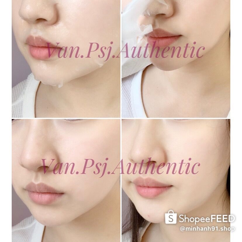 MẶT NẠ WONJIN MẪU MỚI