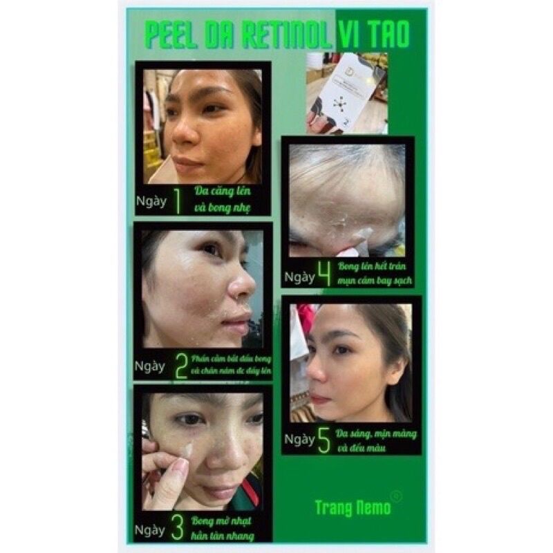 [Hot Hot]Peel Da Vi Tảo Retinol Trang Nemo