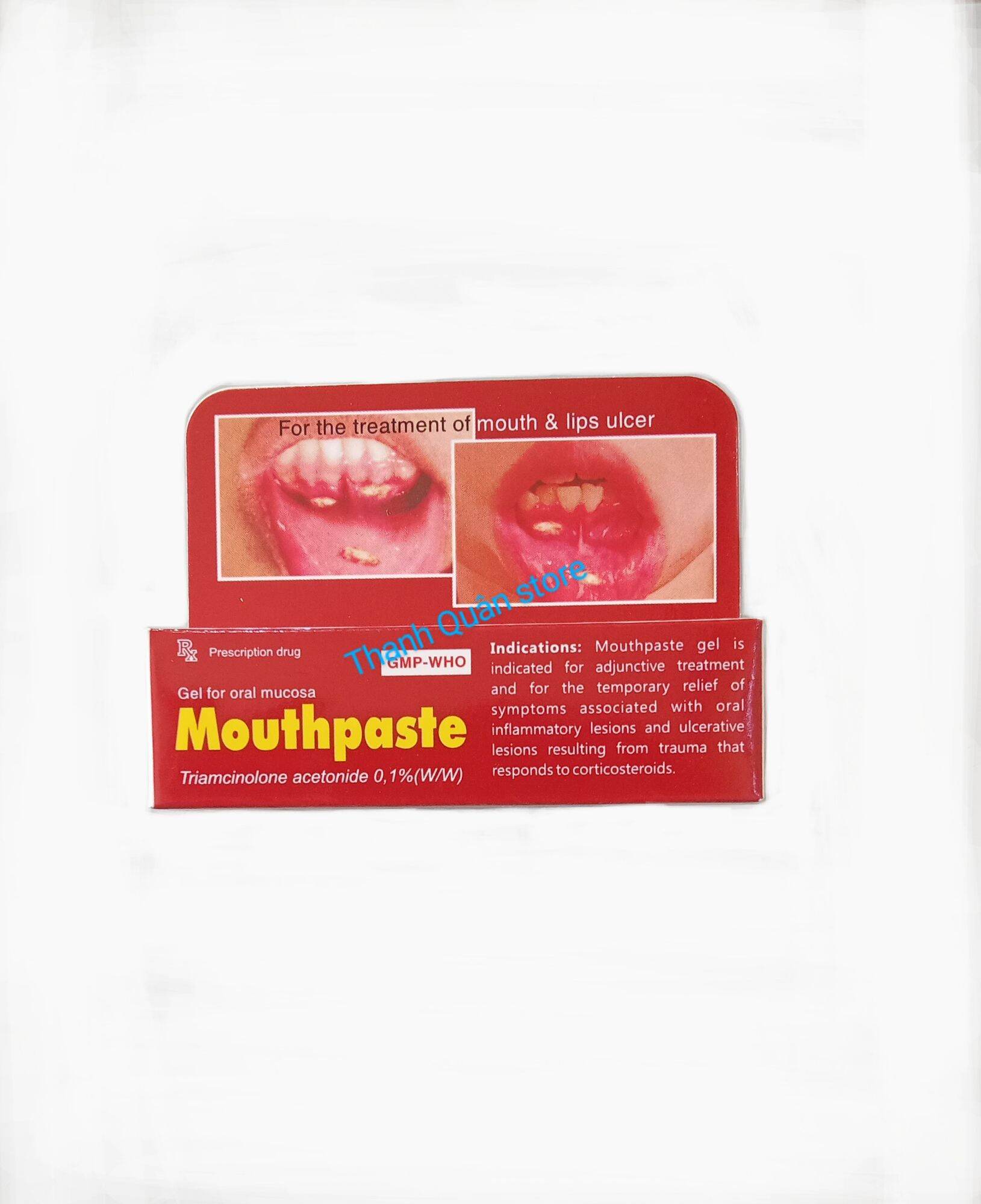Gel bôi nhiệt miệng Mouthpaste 5gr-giảm nhanh và dịu nhanh cơn đau do viêm lở niêm mạc miệng,lợi,môi-Thanh Quân store