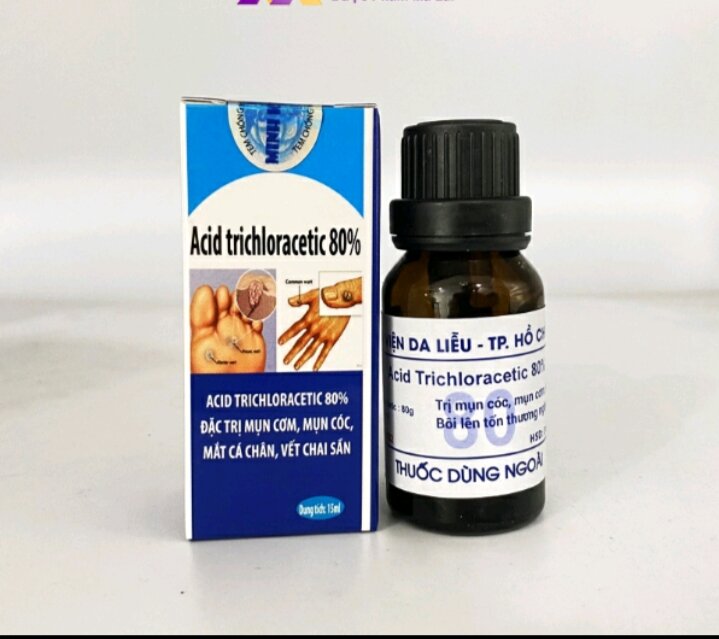 Đánh bay mụn cóc mụn cơm