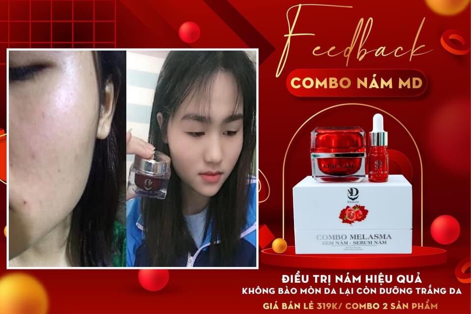 COMBO SỈ 10 HỌP KEM NÁM MD BEAUTY