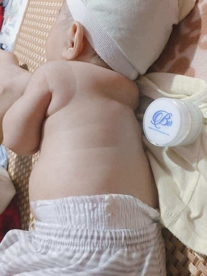 kem đông y đa năng bà vân