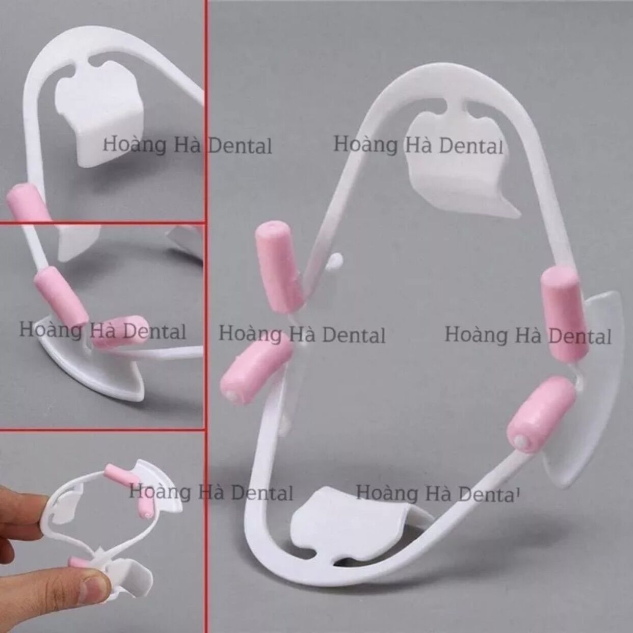 Banh miệng 3D dùng trong nha khoa