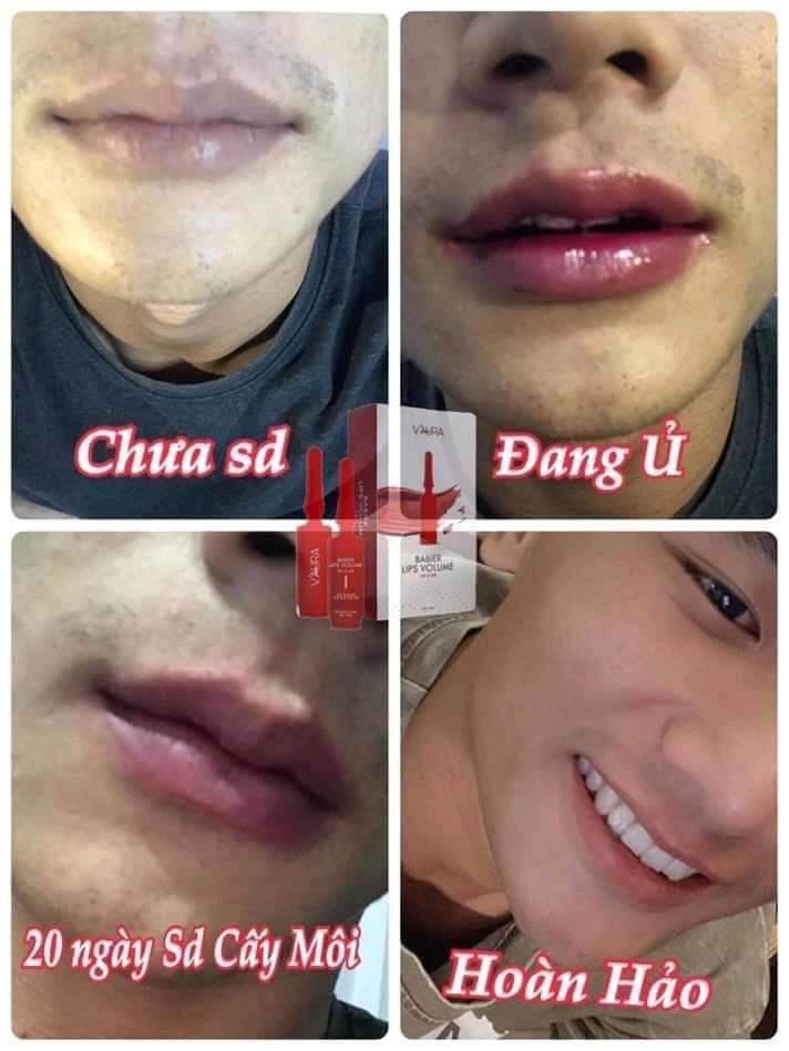 Tinh Chất Babier Lips Volum Xóa Thâm Môi Làm Hồng Môi Thay Phin Xăm