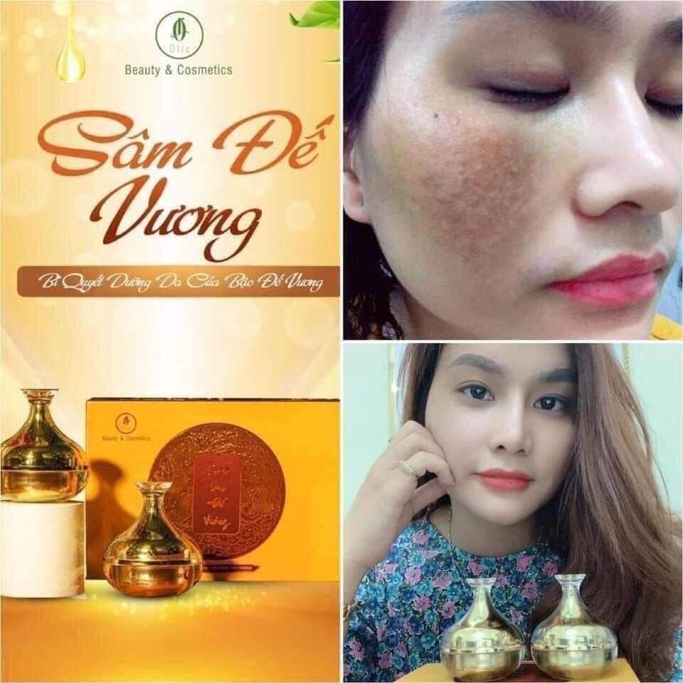 Kem sâm đế vương xoá sạch Nám, Tàn Nhang (gồm 1 kem ngày, 1 kem đêm)