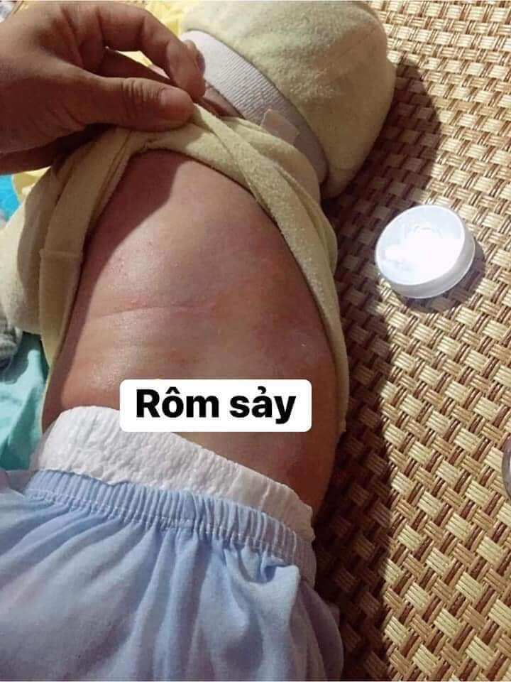 kem đông y đa năng bà vân