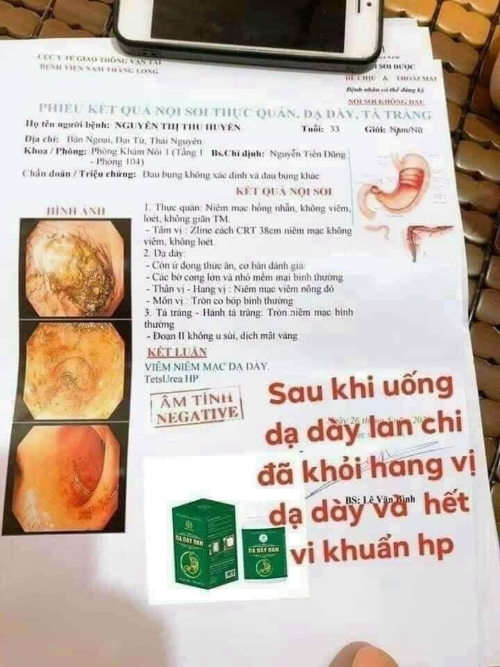 DẠ DÀY ĐAN 👉 trào ngược dạ dày 👉ợ nóng.ợ chua.đau dạ dày