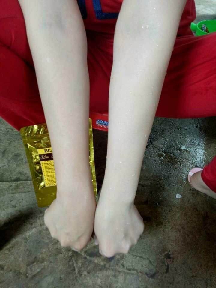Tắm trắng thảo mộc Beauty spa