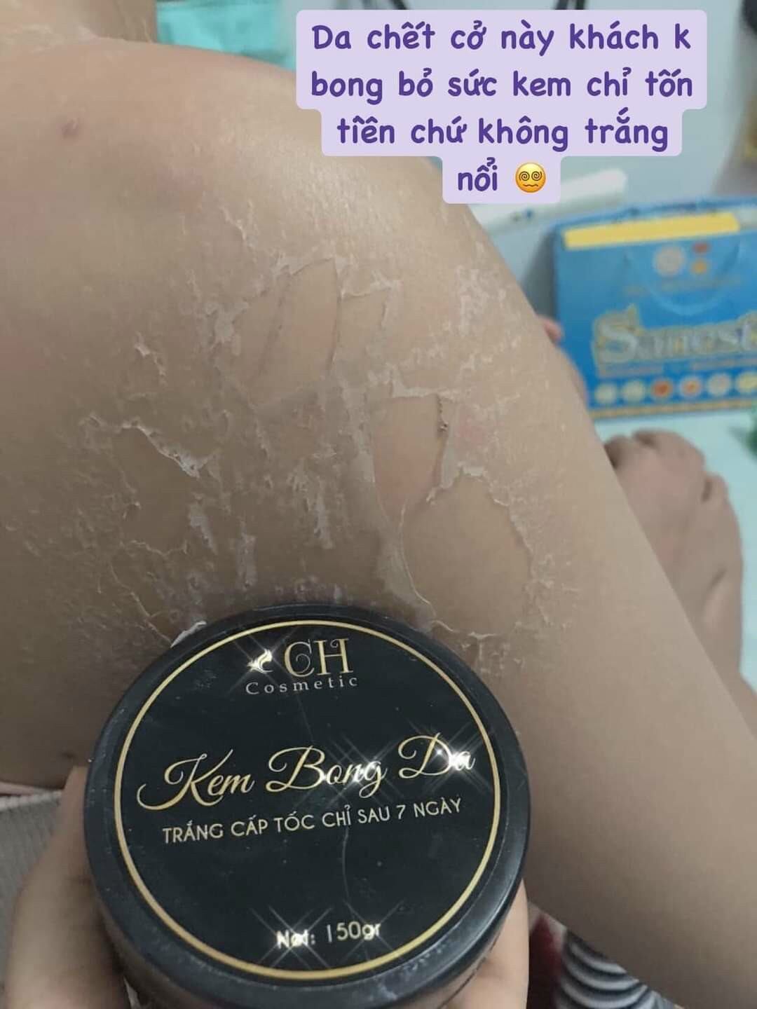 Body Bong Da Trắng Sau 7 Ngày