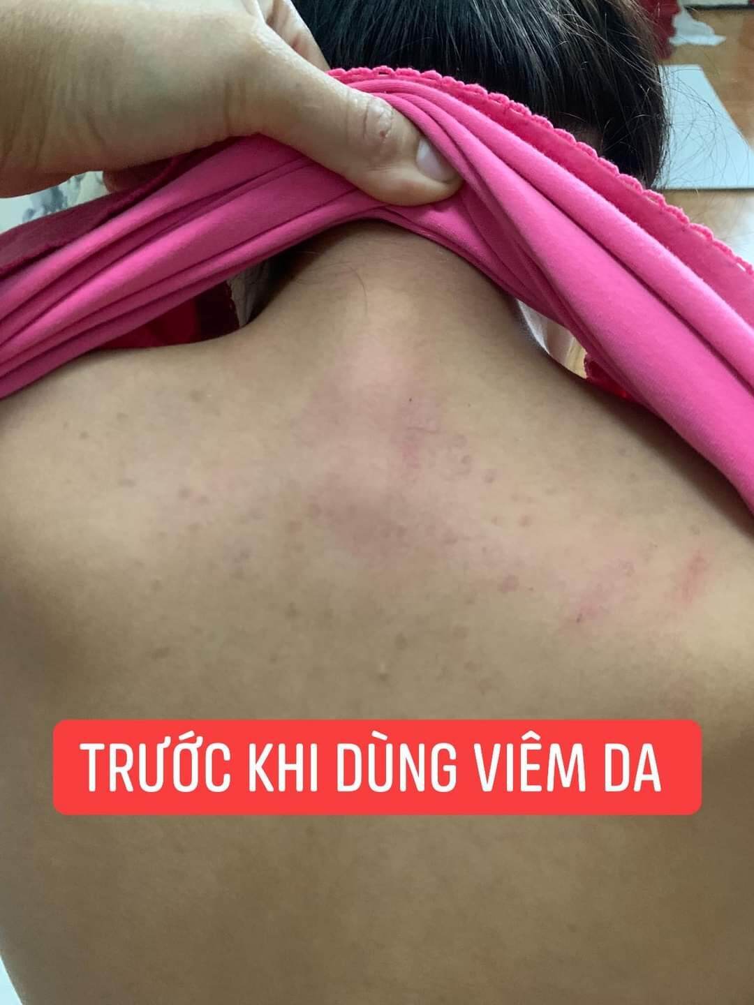 Kem bôi da Thảo Mộc Nam - Mẫu mới 15gr