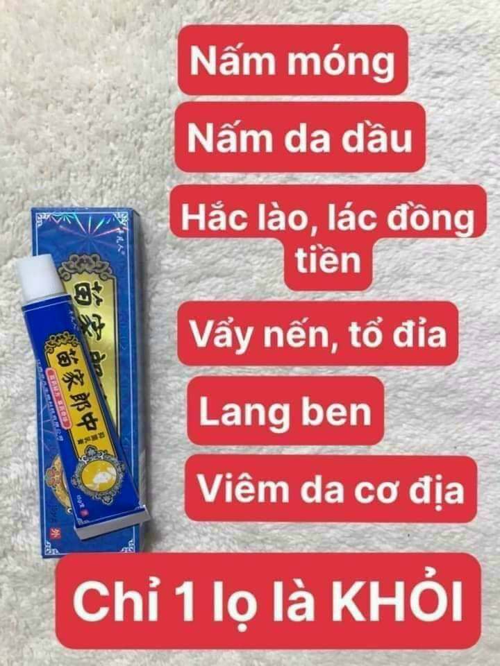 Kem bôi nấm ngứa hắc lào vảy nến lang ben ghẻ lở, tổ đỉa, viêm da cơ địa, date mới