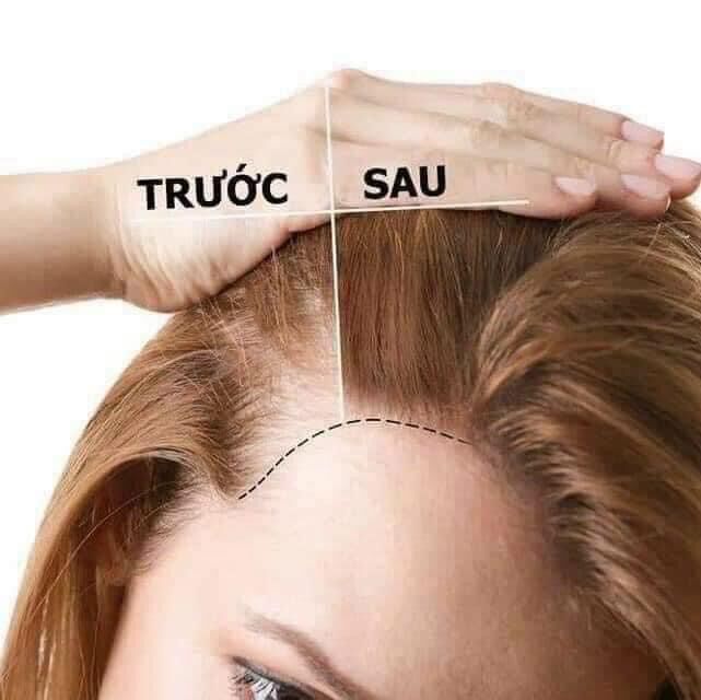 (Mẫu Mới)Viên uống mọc tóc Biotin 120 viên