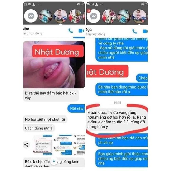 Sâu sún răng Nhật Dương