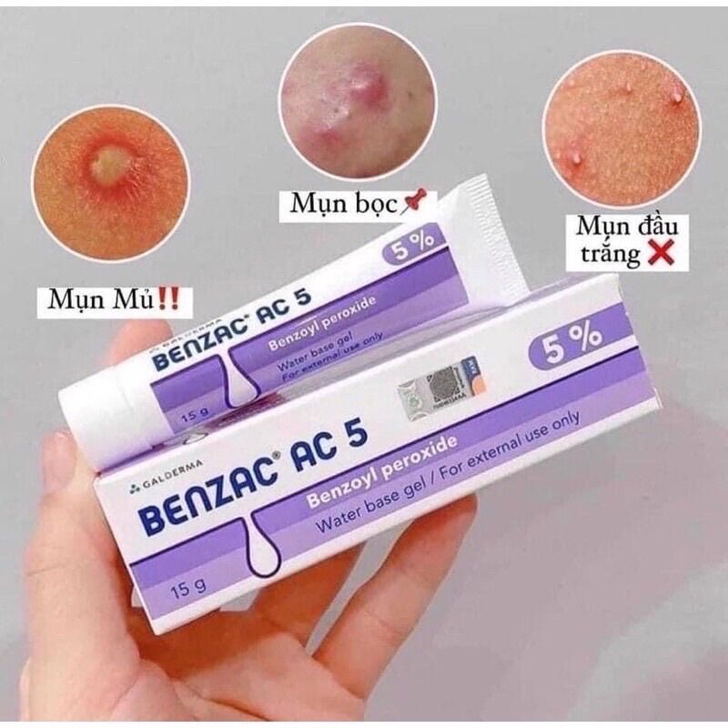 [CHÍNH HÃNG 100%] Kem chấm mụn Benzac AC 5 (5% Benzoyl Peroxide) Thái Lan - 15g