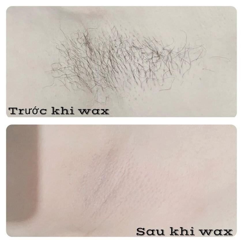 Combo Wax Lông Veo Và Mỡ Trăn Veo Triệt Lông
