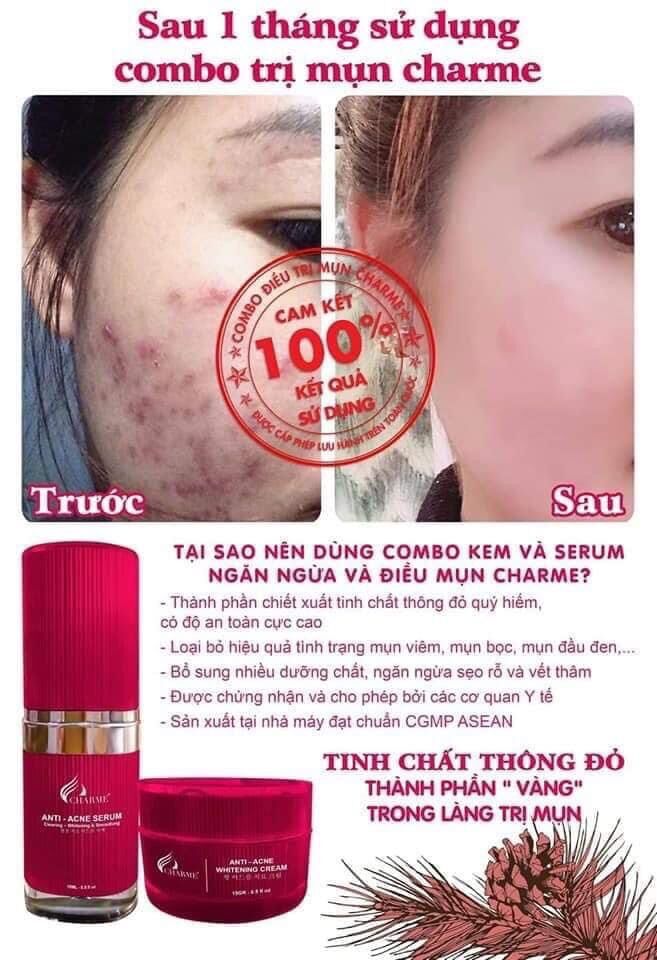 Combo Serum và Kem Thông Đỏ CHARME - Shi91 Cosmetics
