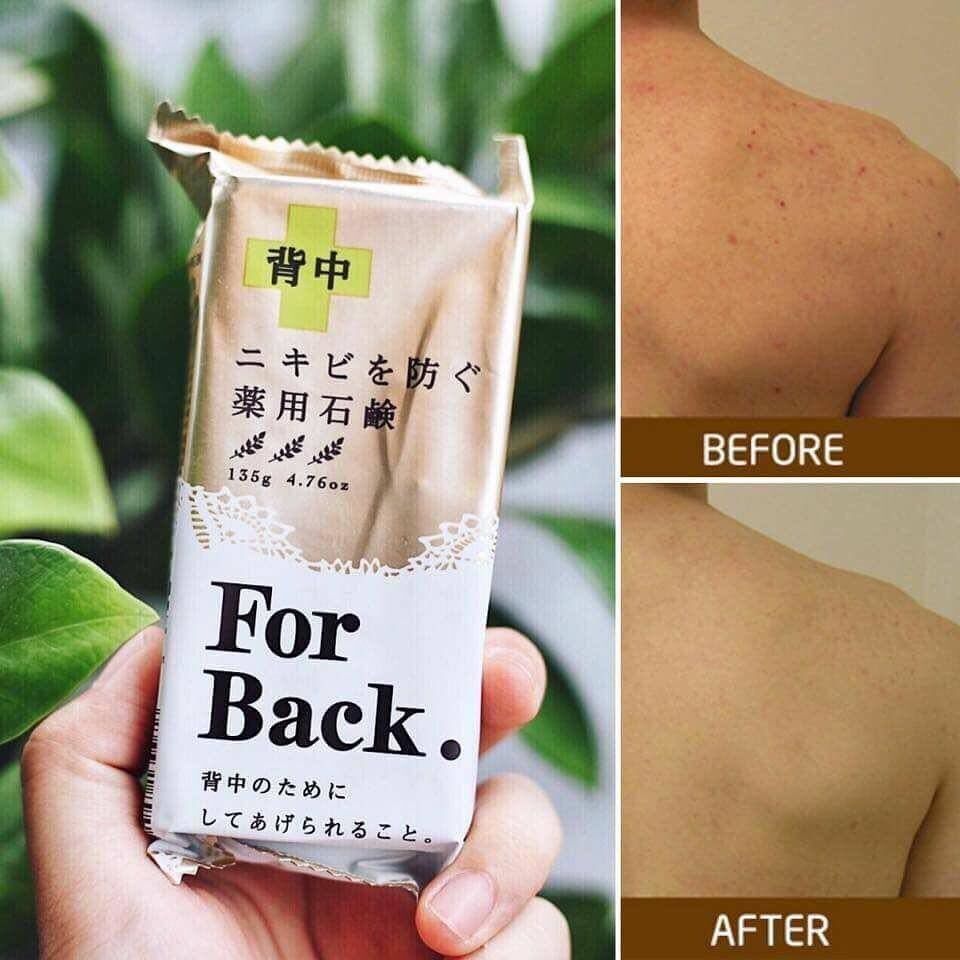 Xà phòng, xà bông giảm mụn lưng For Back Nhật Bản