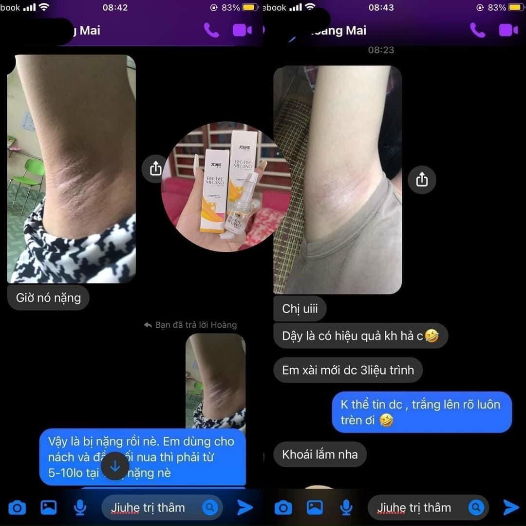 SERUM JIUHE THÂM THANH TÔ BYE BYE MELANO