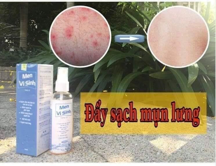 [ HÀNG CHUẨN ] XỊT MEN VI SINH TAVIDA 100ml ĐẨY SẠCH MỤN LƯNG VIÊM NANG LÔNG NẤM DA GHẺ NGỨA MANG LẠI CHO BẠN LÀN DA SẠCH VÀ ĐẦY SỨC SỐNG