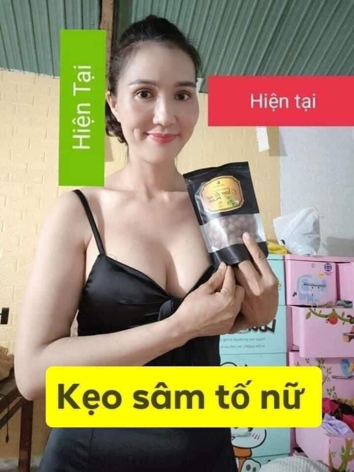 Combo 5 hộp kẹo mầm sâm tố nữ Plus