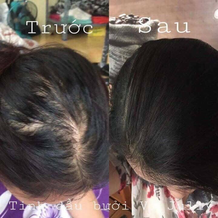 [COMBO NGĂN RỤNG TÓC HIỆU QUẢ] Dầu Gội Bưởi + Tinh Dầu Bưởi