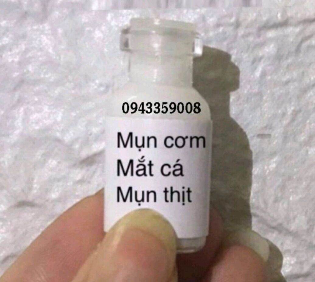 Kem tẩy nốt ruồi tàn nhang, mắc cá,mụn thịt, mụn cóc