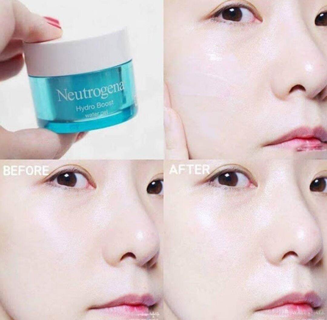 Kem dưỡng cấp ẩm Neutrogena Hydro Boost Water Gel - Da Dầu