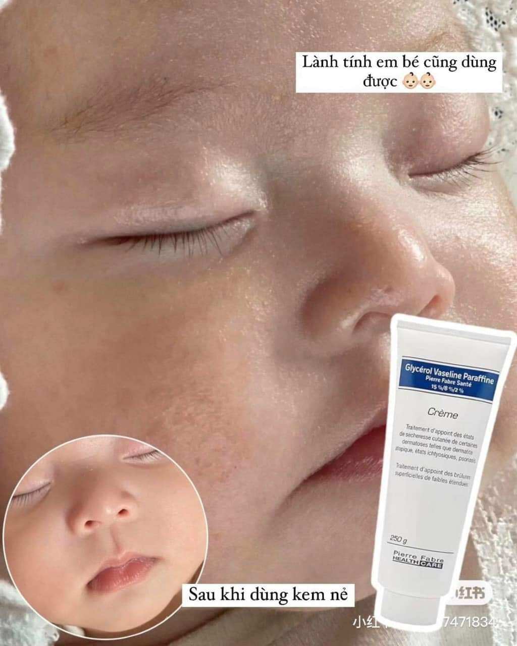 Kem nẻ chàm Dexeryl 250ml chính hãng