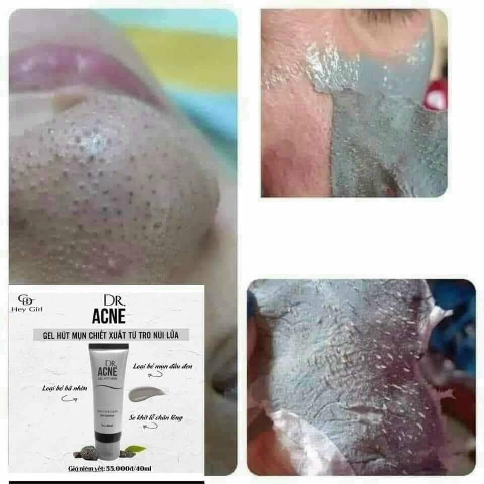 Gel lột mụn dr acne