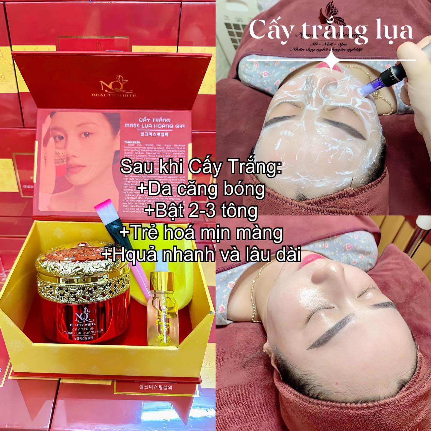 Cấy trắng lụa mẫu mới - cấy trắng spa - QL 90