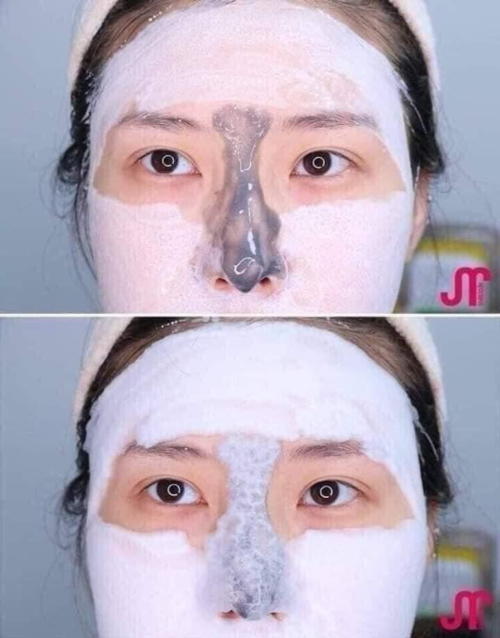 Thải độc tím, thải độc chì mhspa