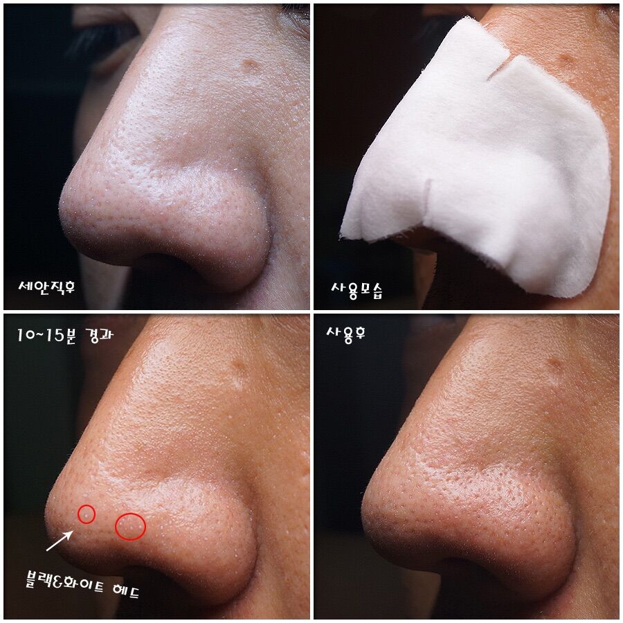 Miếng đẩy mụn đầu đen Ciracle Goodbye blackhead
