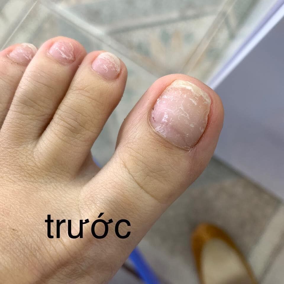 dưỡng phục hồi móng CND