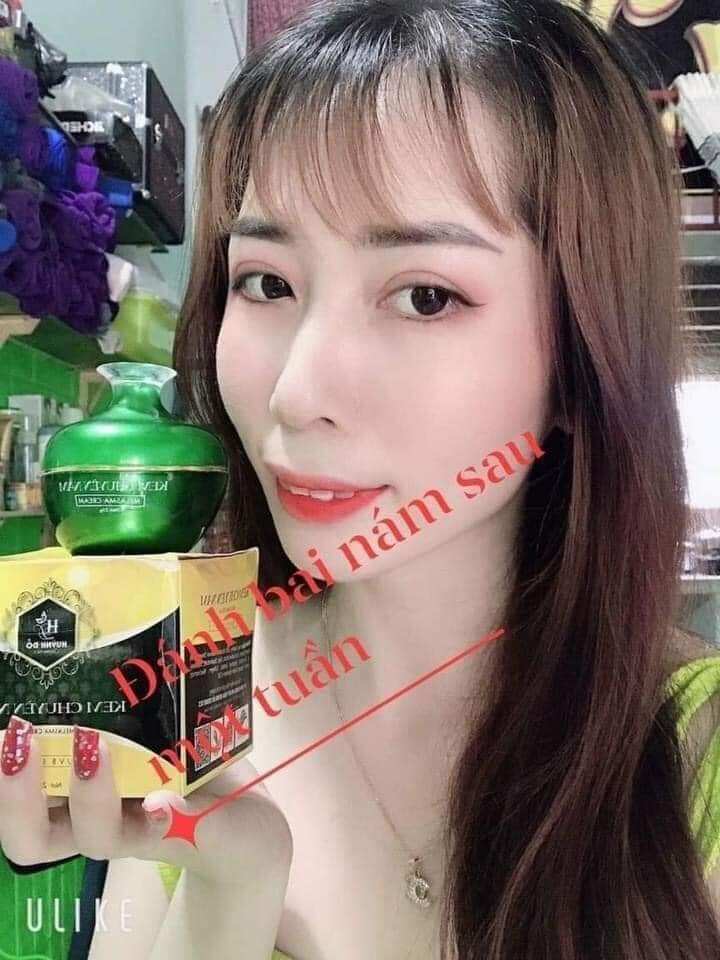 kem chuyên nám Huỳnh Đỗ