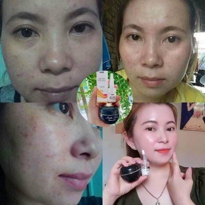 Kem Nám Balla Luta ,