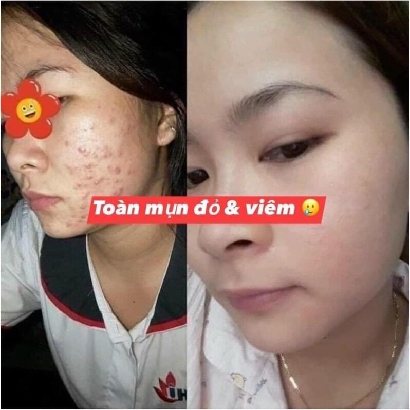 Kem Dữơng Trắng Sáng Da Face Queen Mini