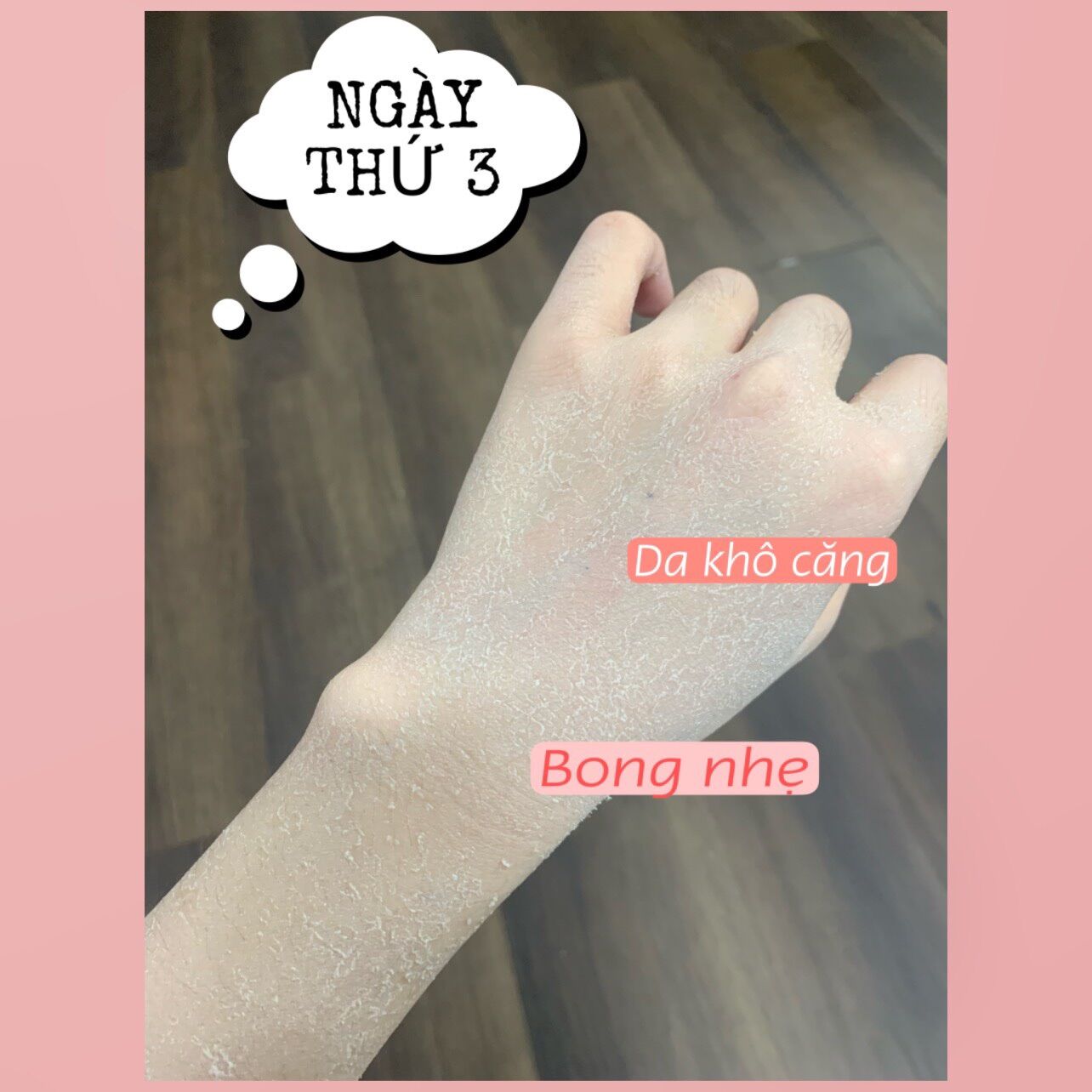 1 TYP KEM DƯỠNG TRẮNG DA RETINOL