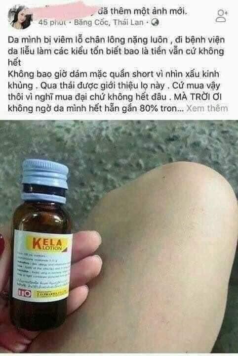 kela viêm nang lông 60ml thái lan