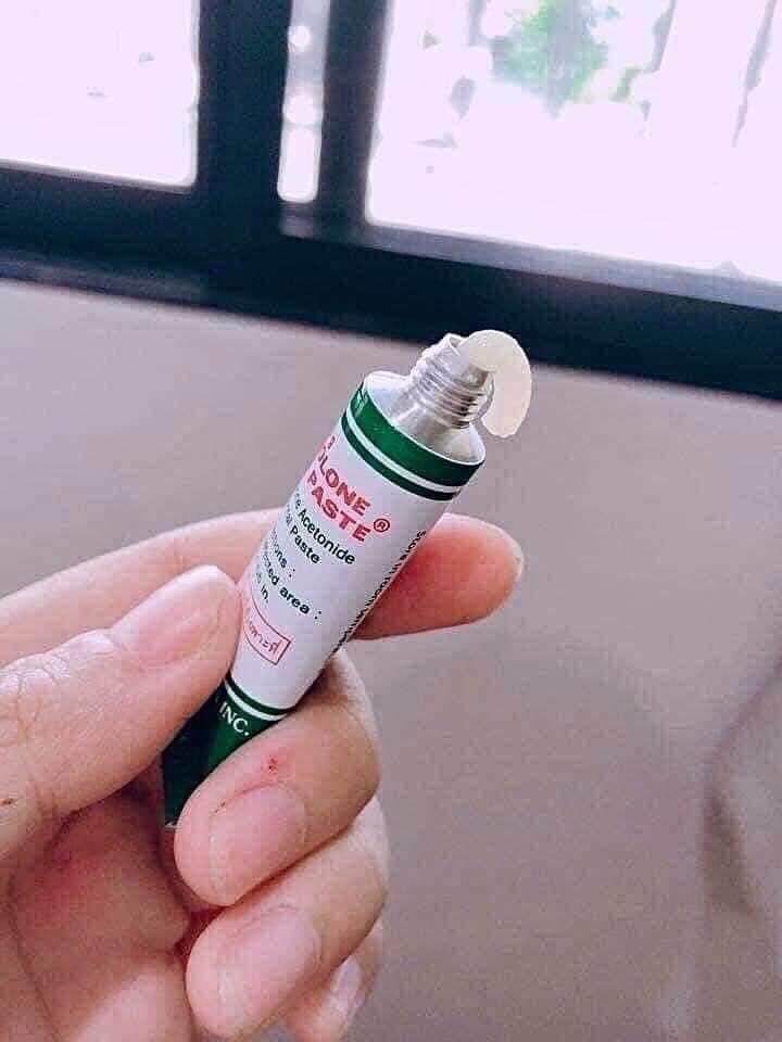 Kem Bôi Nhiệt Miệng Trinolone Oral Paste Thái Lan