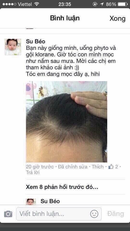 kẹo biotin mọc tóc Phyto Pháp