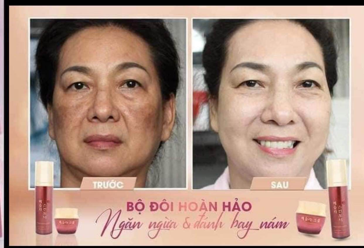 Kem mờ Nám Hàn Quốc The Nature Book 50g làm mờ nám chỉ sau 28 ngày sử dụng