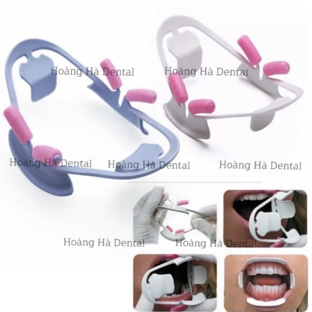 Banh miệng 3D dùng trong nha khoa